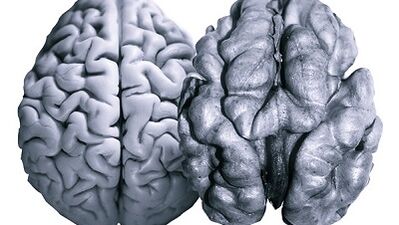 Noci utili per l'attività cerebrale