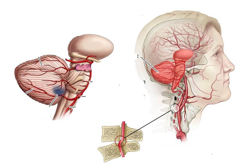 Cerebellare